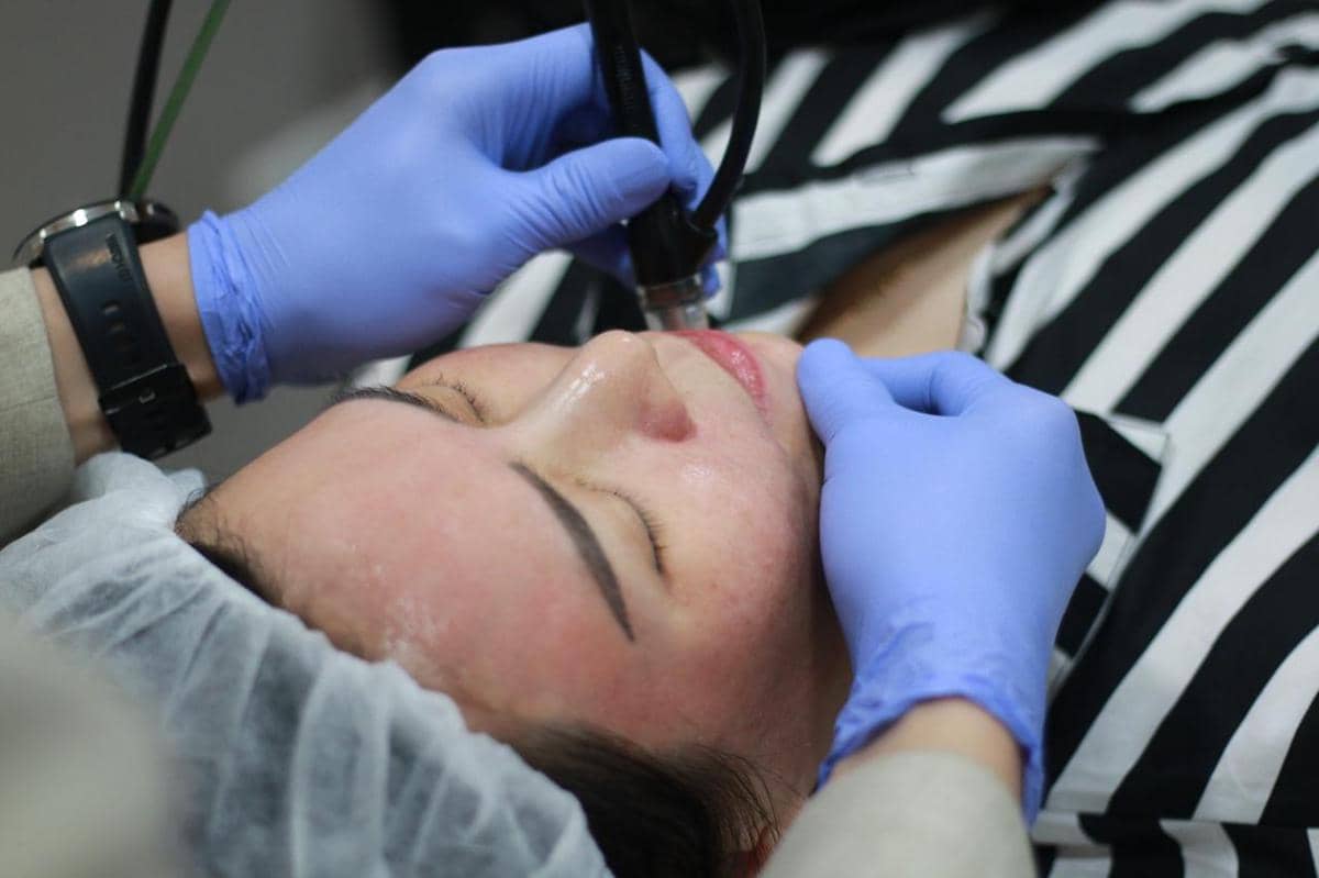 Miracle Aesthetic Clinic, Tangani Hiperpigmentasi Kulit Indonesia