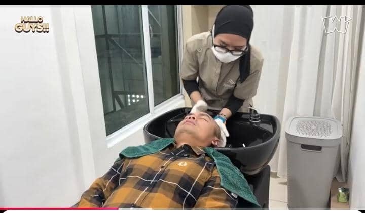 potret Wendi Cagur transplantasi rambut