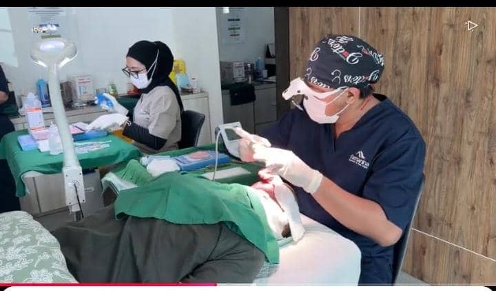 potret Wendi Cagur transplantasi rambut