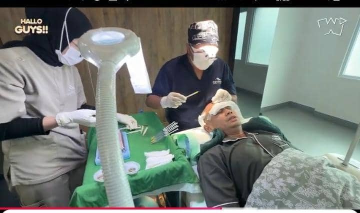 potret Wendi Cagur transplantasi rambut