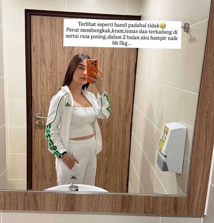 potret Chelsea Olivia jalani 4 operasi sekaligus