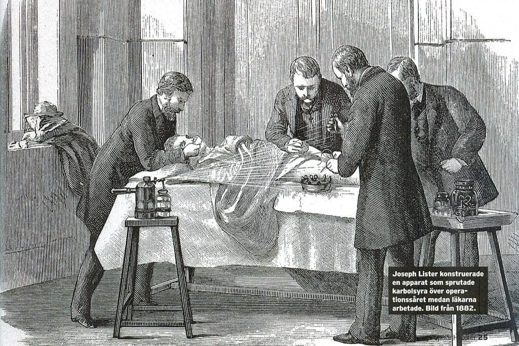 Ilustrasi Joseph Lister ketika mengoperasi pasien dengan menyemprotkan phenol atau carbolic acid