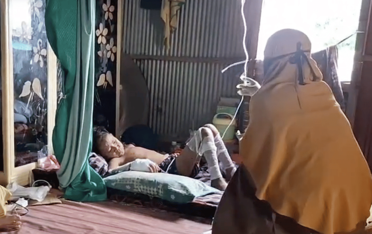 Obat Gratis, Akses Tak Gratis: Kusta di Pelosok dan Jalan Panjang Eliminasi 2030