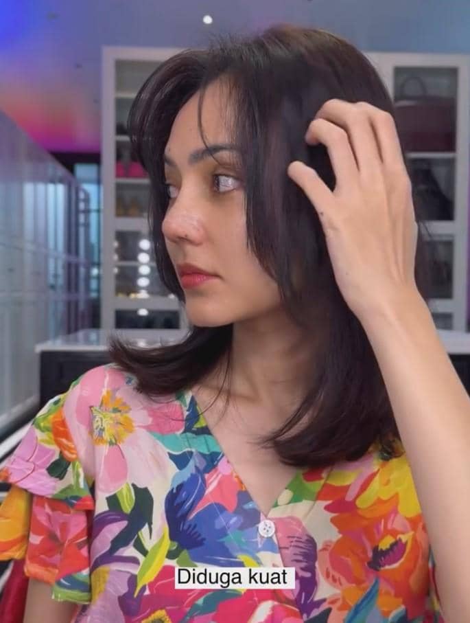 Rina Nose Operasi Hidung (instagram.com/rinanose16)