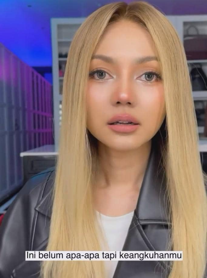 Rina Nose Operasi Hidung (instagram.com/rinanose16)