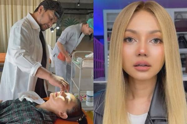 7 Potret Hidung Baru Rina Nose usai Operasi Plastik di dr. Tompi