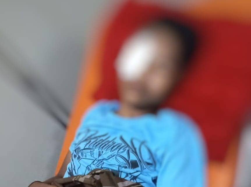 Senjata Mainan Makan Korban, Remaja Gowa Kena Peluru Gel di Bola Mata