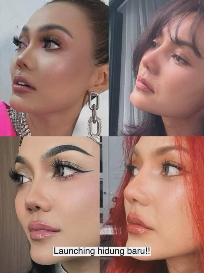 Rina Nose Operasi Hidung (instagram.com/rinanose16)