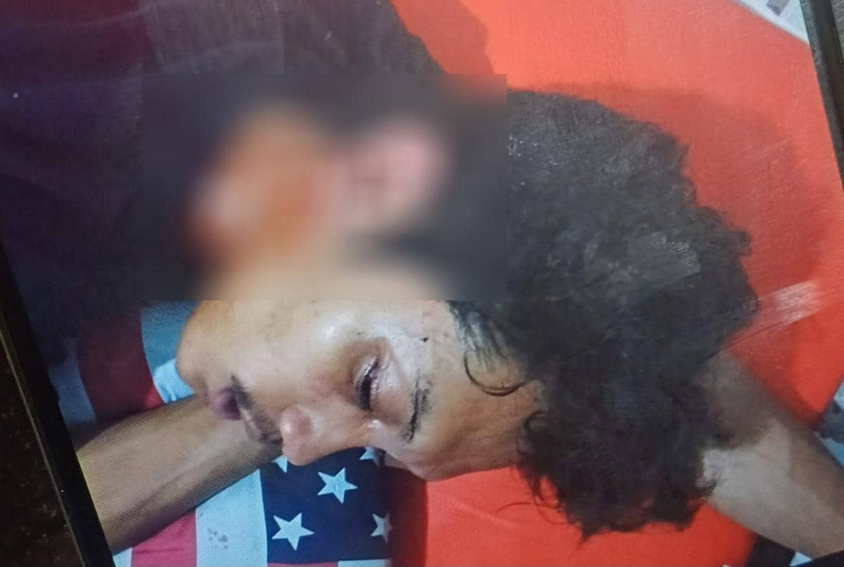 Kampus UNM Dilempari Molotov, Dua Mahasiswa Terluka