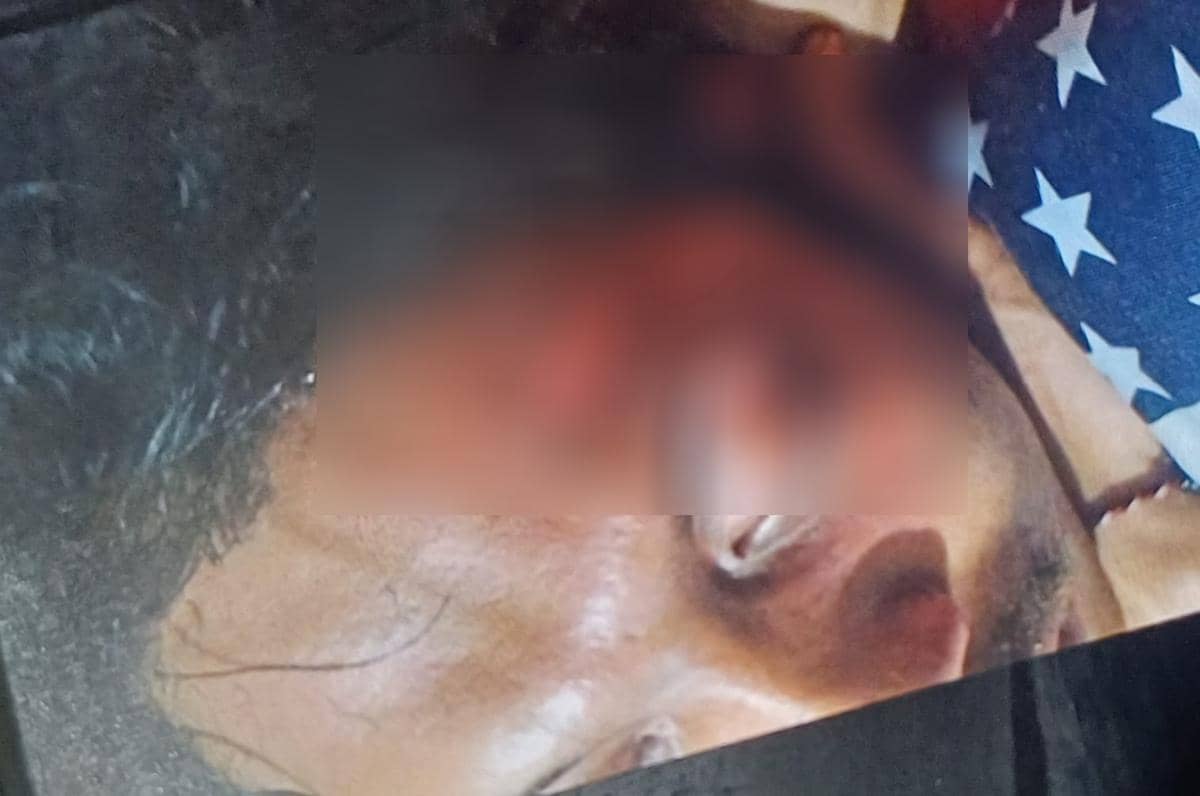 Dua mahasiswa terluka akibat serangan molotov oleh orang tak dikenal di kampus UNM Gunung Sari. (Dok. IDN Times)