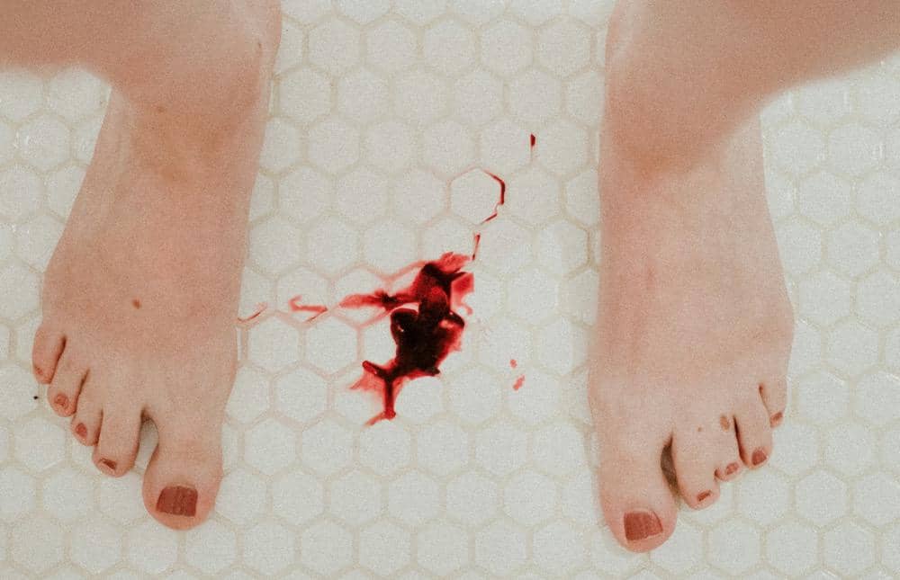 Pendarahan pada perempuan