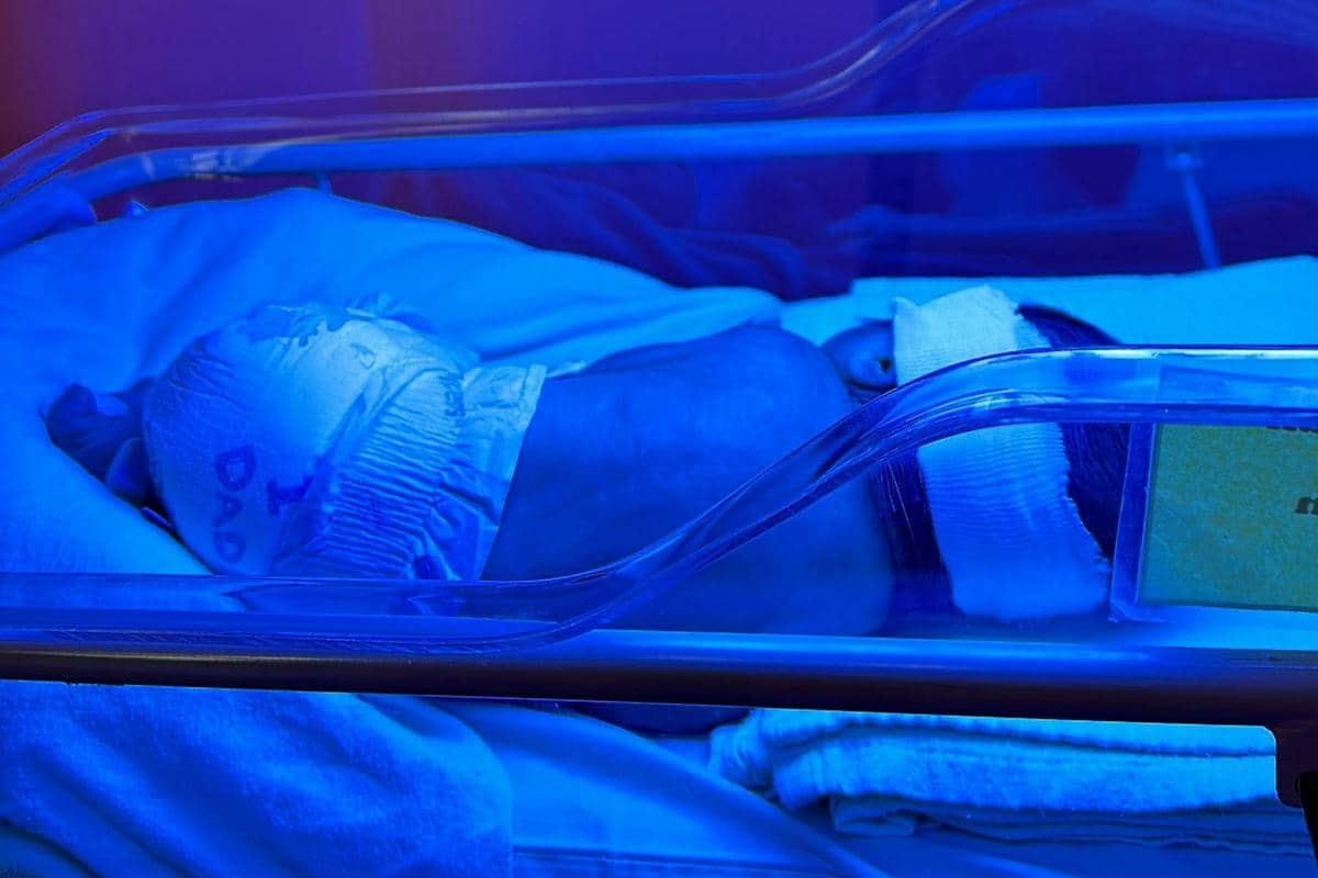 Bayi menjalani fototerapi di dalam inkubator.