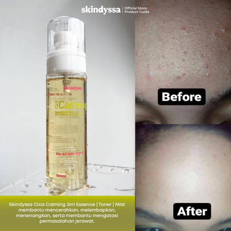 Skindyssa Cica Calming Essence Toner