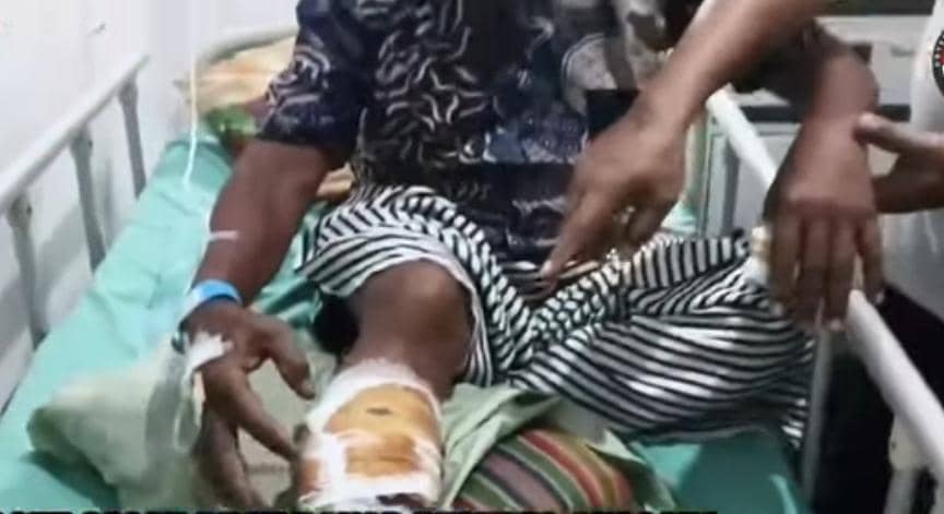 Kapolsek Sosoh Buay Rayap saat menjenguk korban yang diserang beruang.