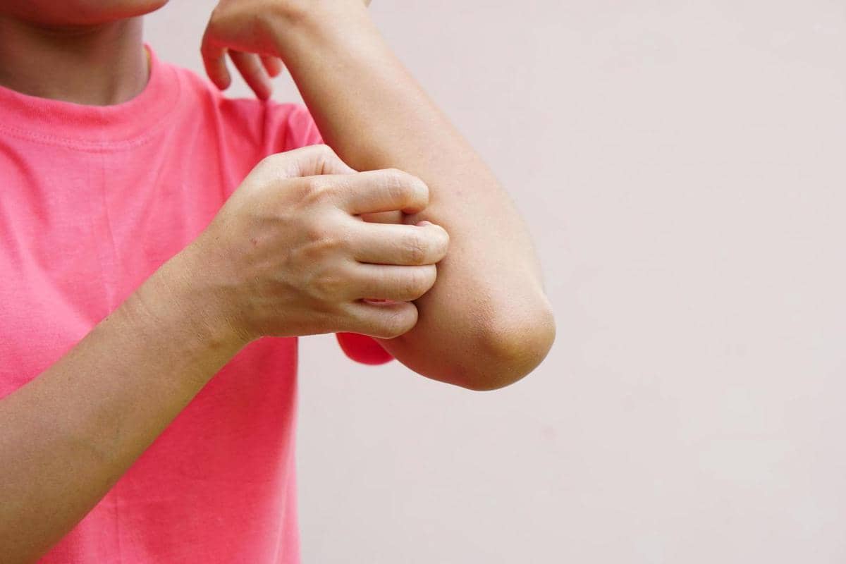 ilustrasi menggaruk kulit