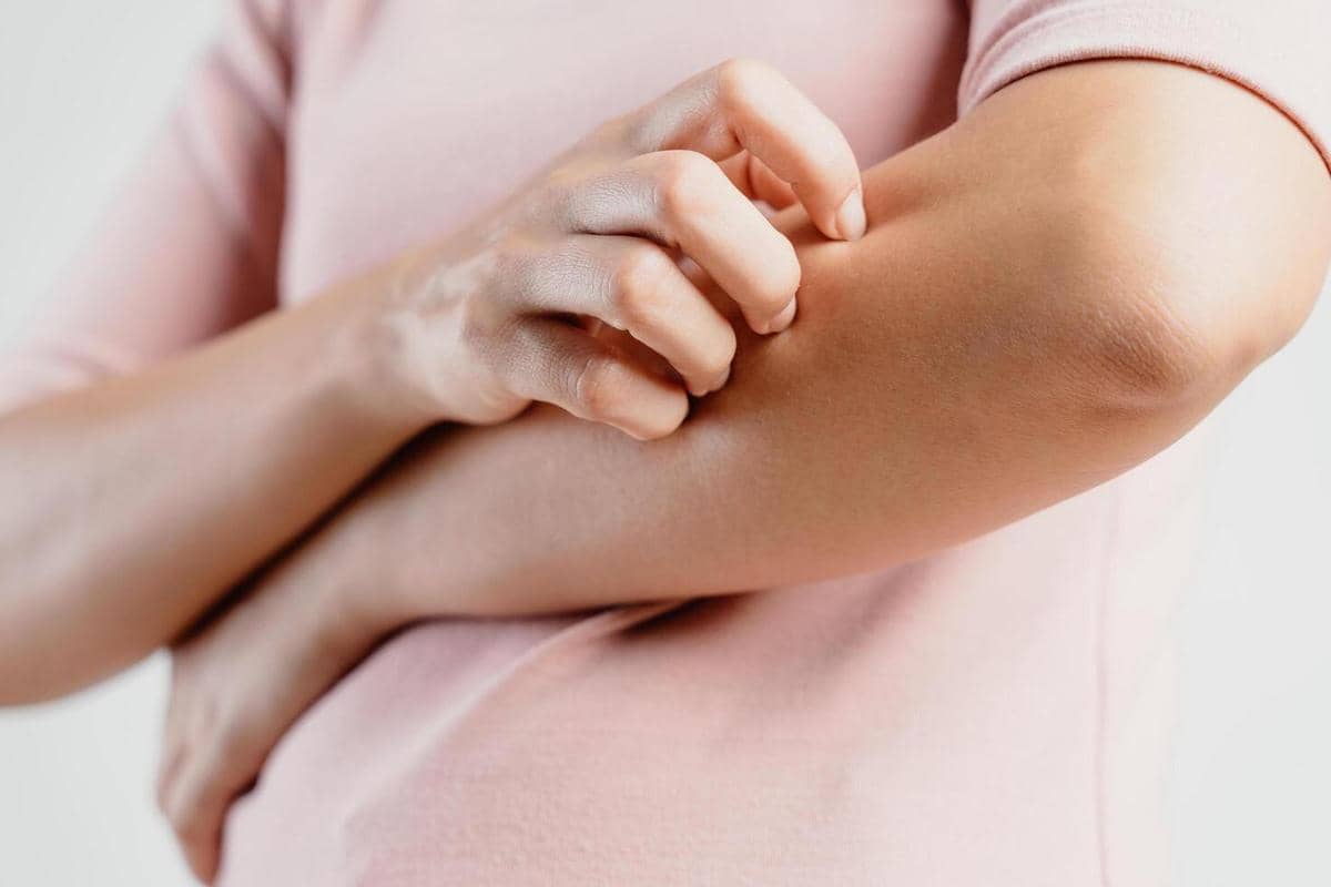 ilustrasi menggaruk kulit