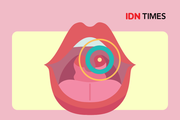 10 Gejala Batu Amandel, Bukan Cuma Bau Mulut ya!