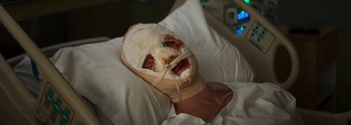 Matt Hagen dengan wajah dibalut perban penuh terbaring di ranjang rumah sakit, tampak luka di area wajah dan mata terbuka menatap.
