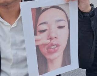 Foto salah satu korban yang mengalami cacat permanen pada bagian bibirnya akibat tindakan medis ilegal yang dilakukan Jeny Rahmadial Fitri