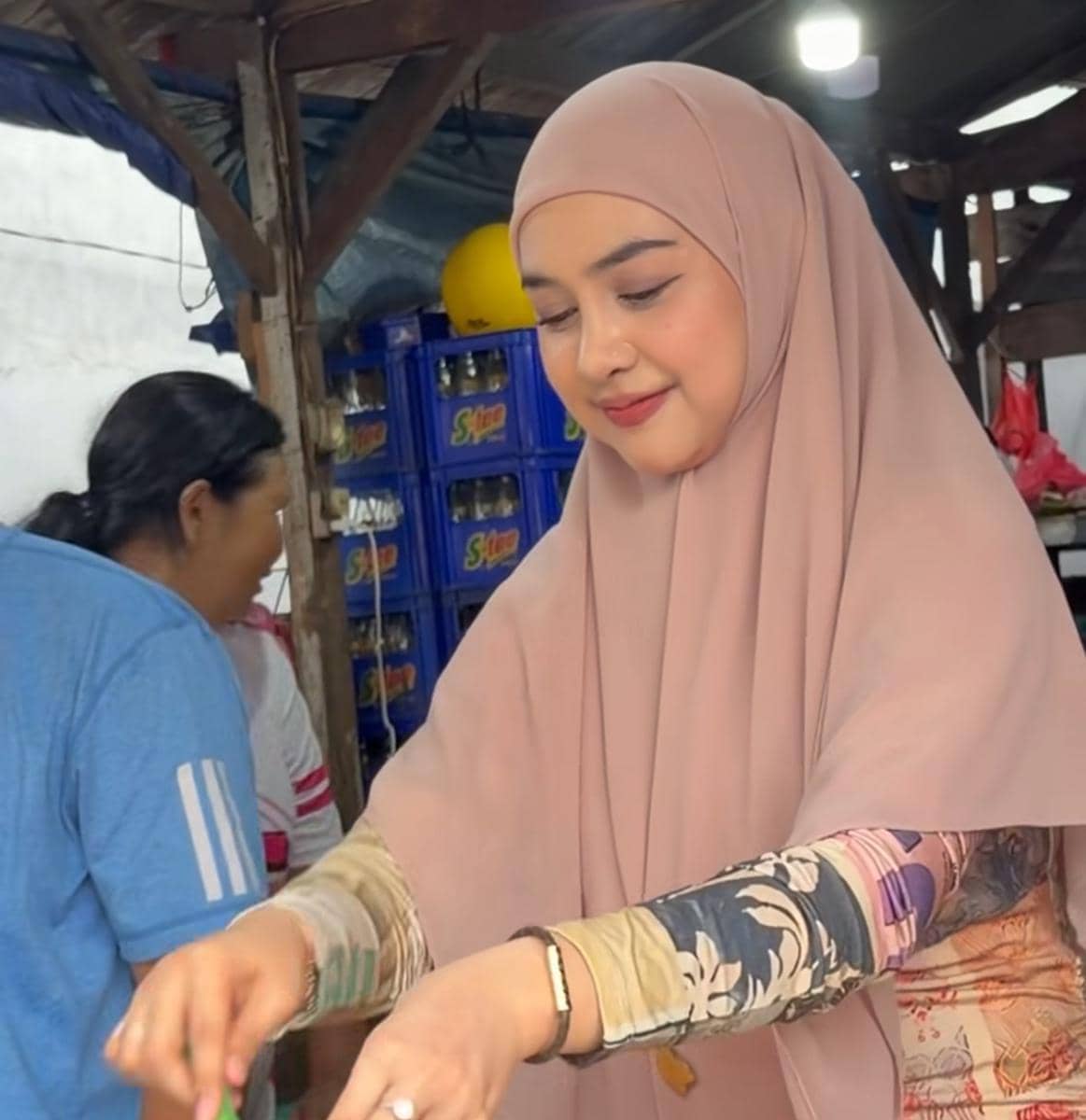 Ria Ricis setelah OP hidung