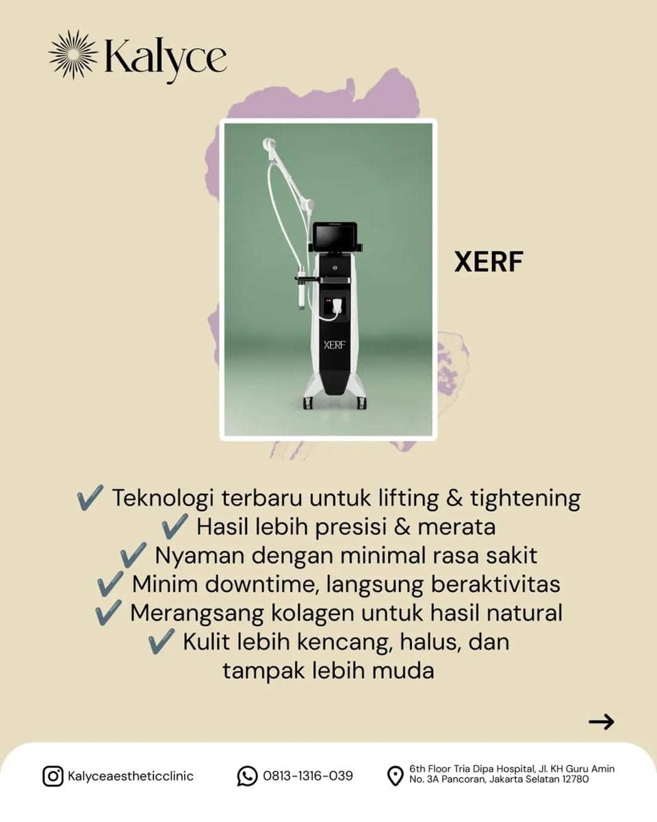 Teknologi canggih untuk hasil yang lebih maksimal ✨Di Kalyce Aesthetic Clinic, kami menghadirka.jpg