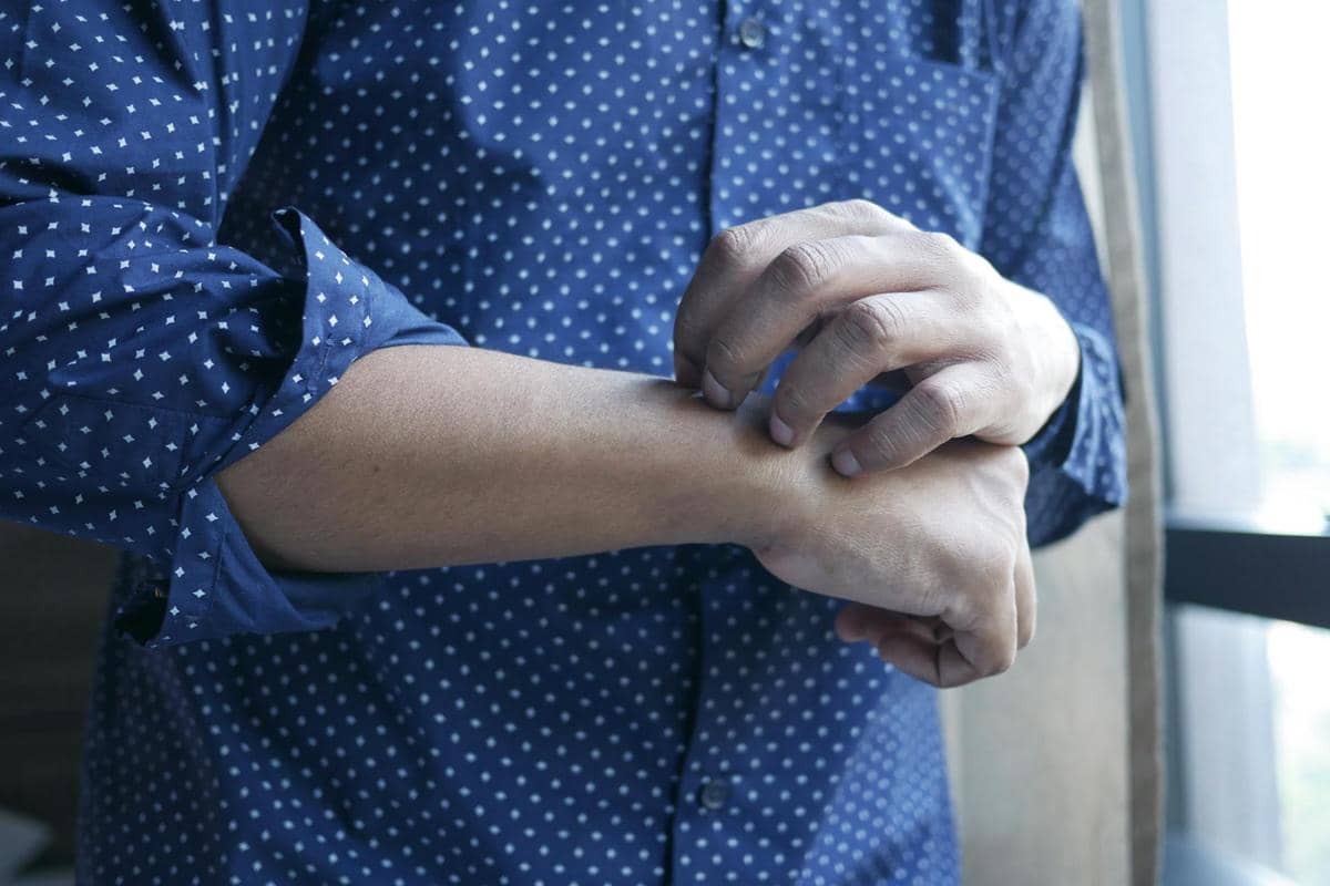 Apakah Kolesterol Tinggi Menyebabkan Gatal? Ini Penjelasannya