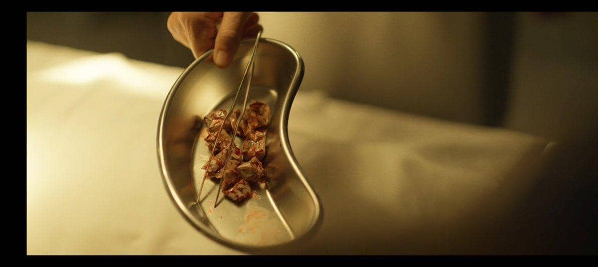 Tangan memegang pinset di atas wadah logam berisi potongan daging berdarah dalam adegan drama The Scarecrow.