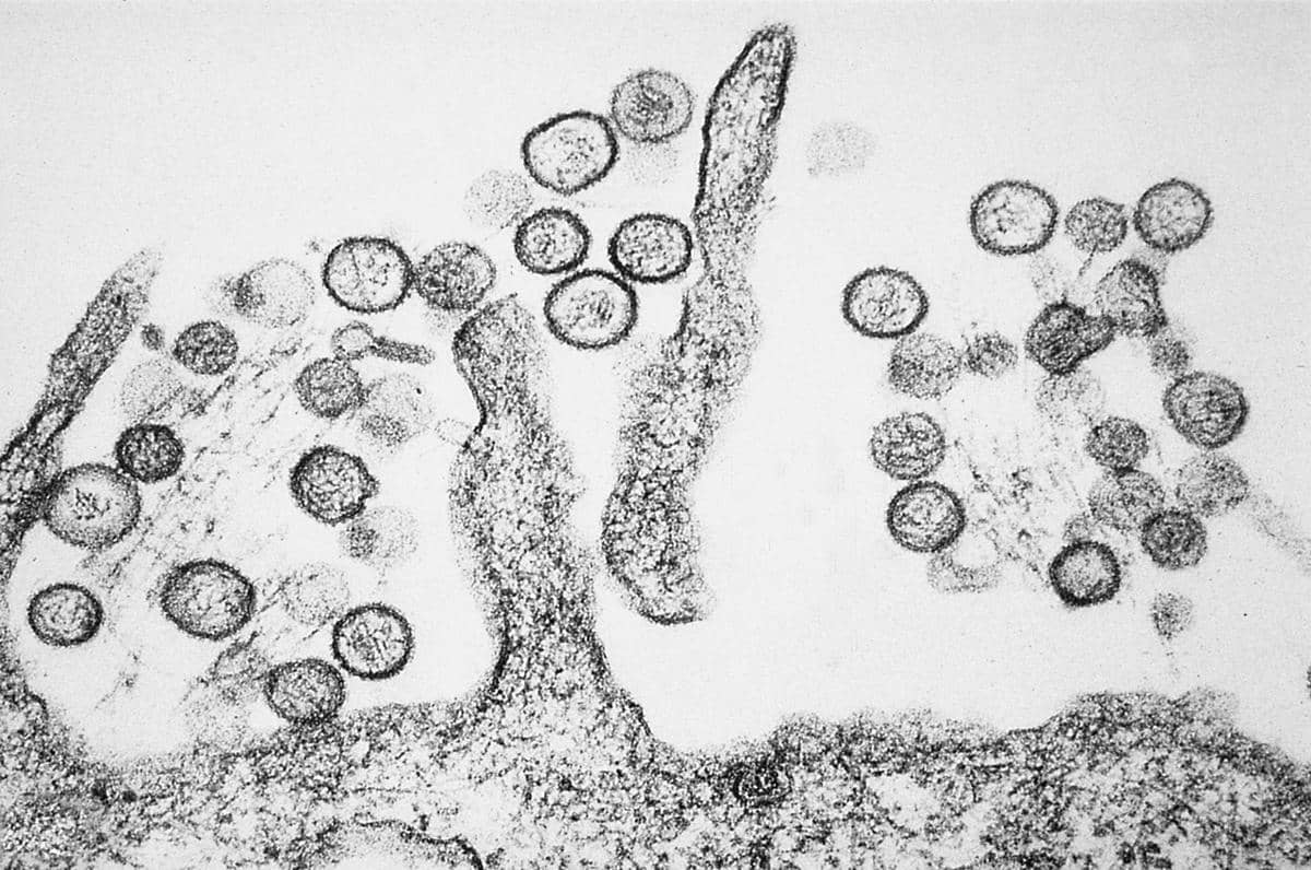 Mikrograf elektron memperlihatkan partikel bulat hantavirus dengan detail struktur virus yang tampak di bawah mikroskop elektron.