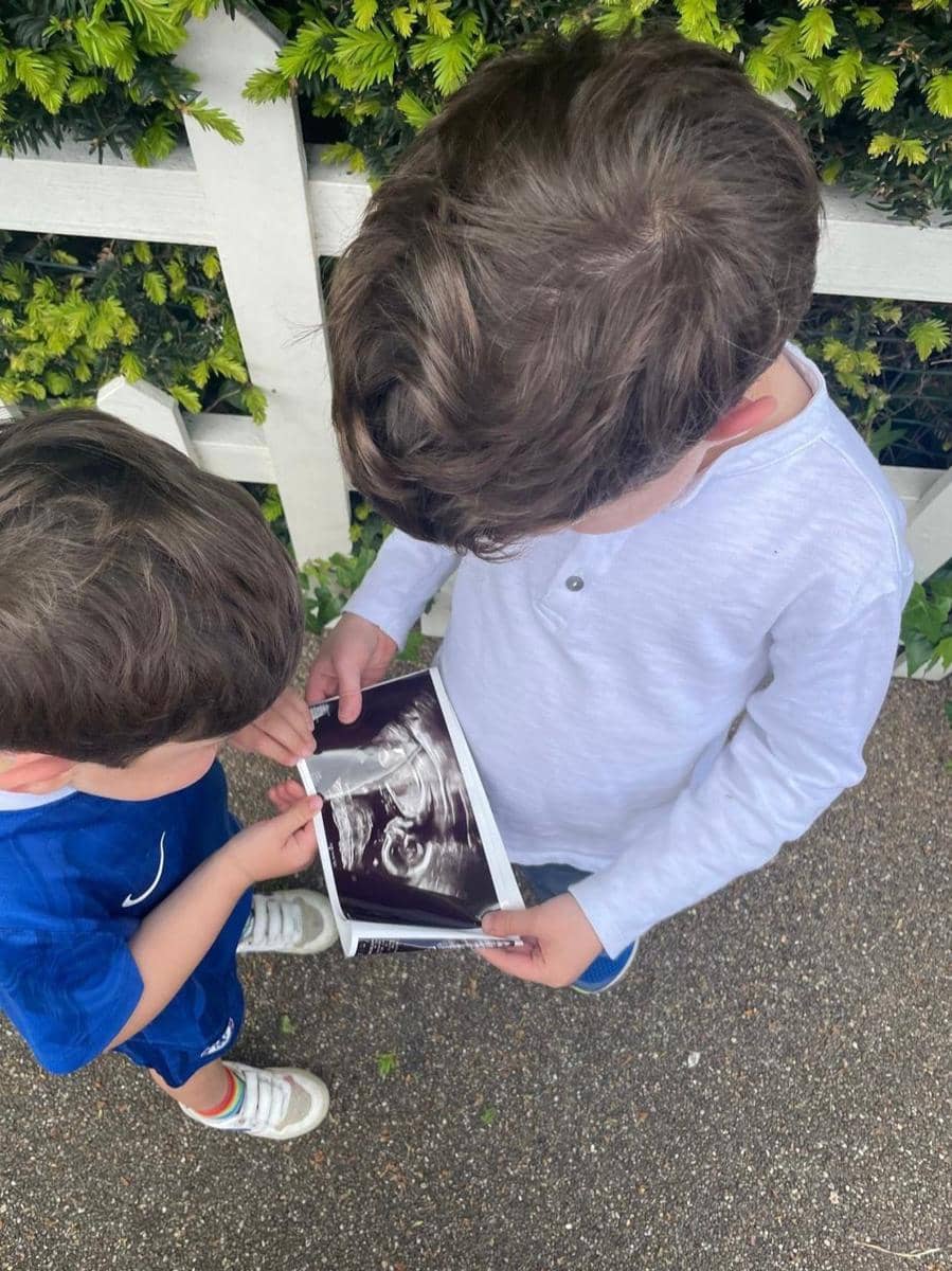 Princess Eugenie hamil anak ketiga 