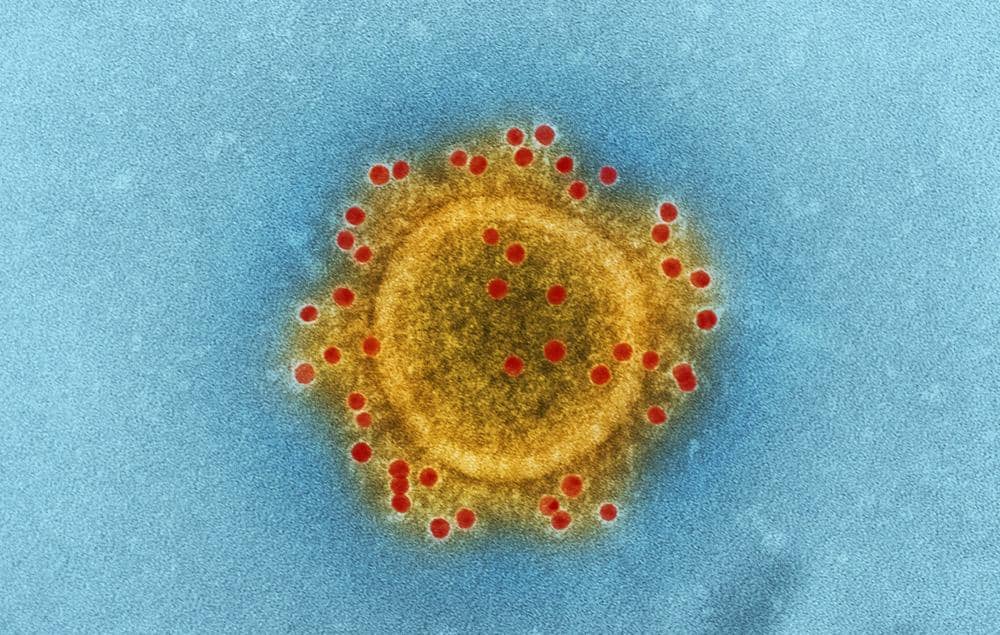 Hantavirus yang sedang menyebar