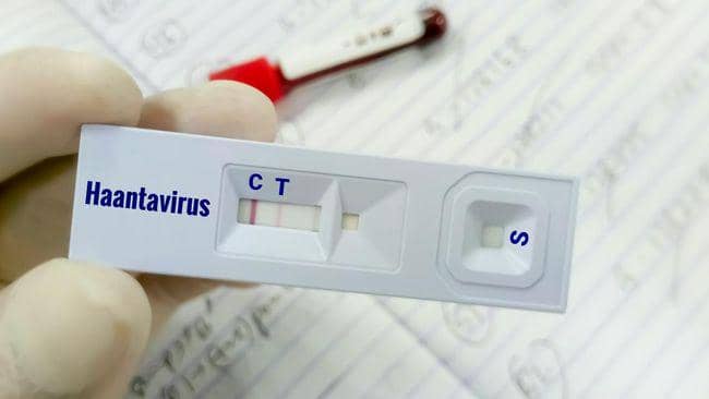 Warga Kalbar yang Terpapar Hantavirus Meninggal, Tubuh Menguning