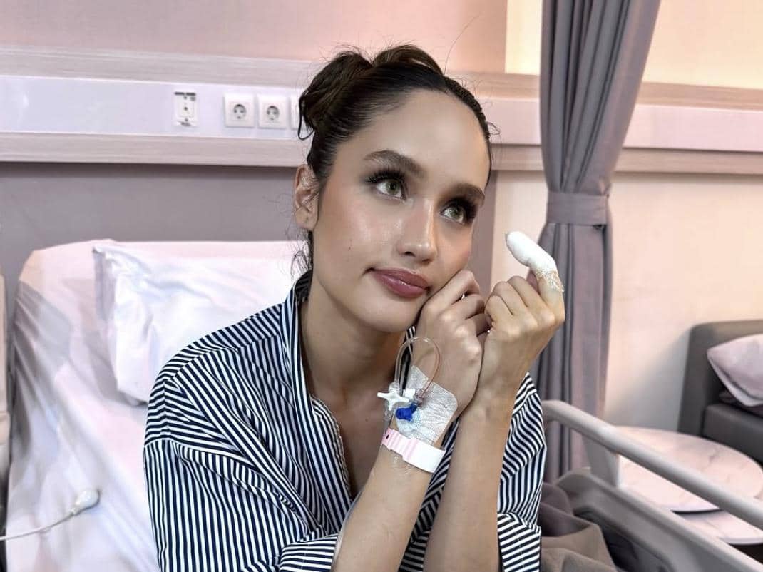 7 Potret Cinta Laura usai Jalani Operasi, Jarinya Terluka Kena Pisau