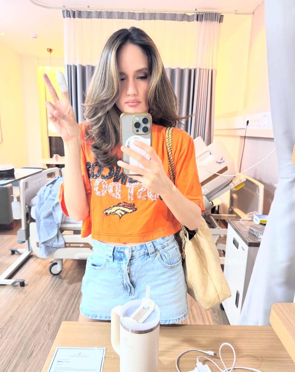 Cinta Laura jalani operasi jarinya kena pisau