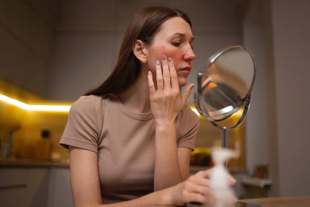 Seorang perempuan yang mengalami gejala lupus