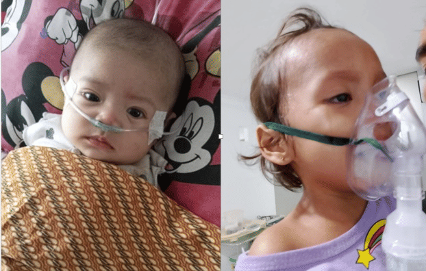 Anak anak alami sesak napas.png