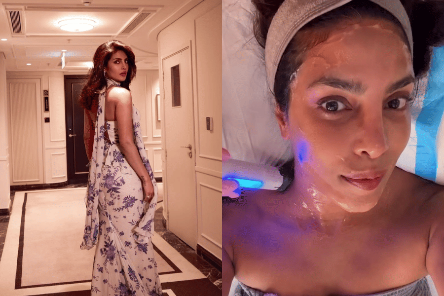 Bukan Sekadar Tren, Ini Pilihan Treatment Priyanka Chopra Jonas