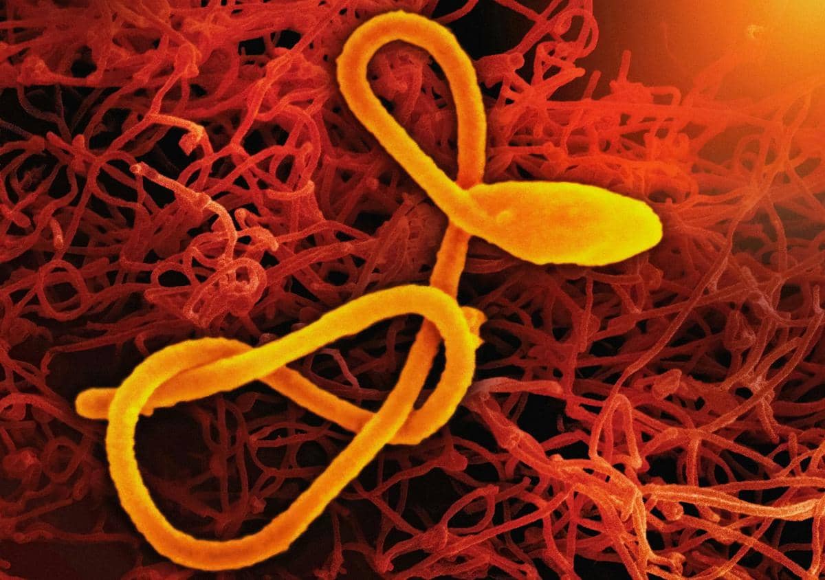 Virus Ebola yang sangat mematikan. 