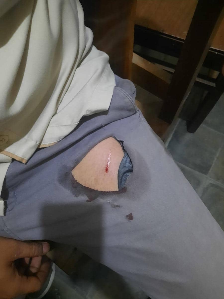 Luka akibat bacokan celurit. (Dok. Polres Bantul)