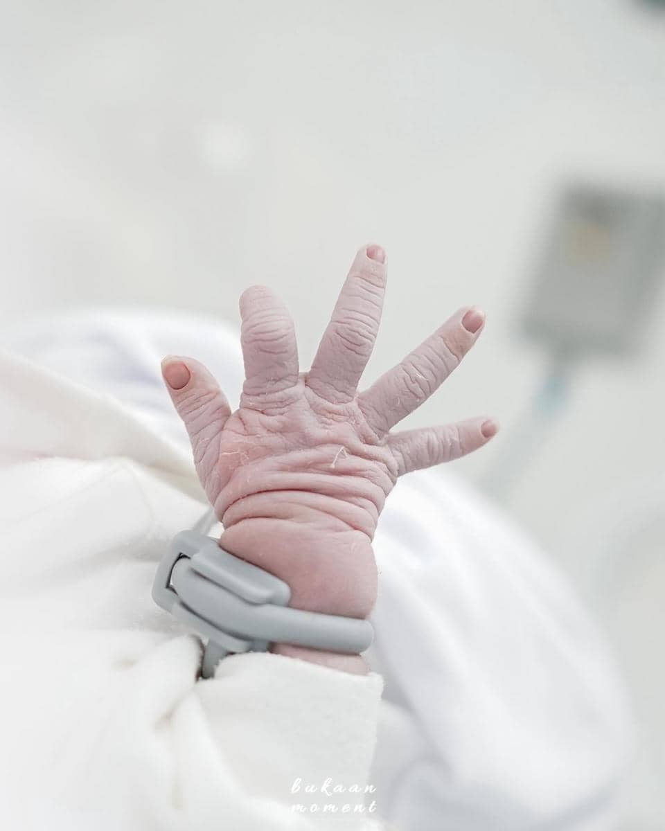 Tangan bayi yang baru lahir dengan kulit keriput mengenakan gelang identitas rumah sakit di atas kain putih.