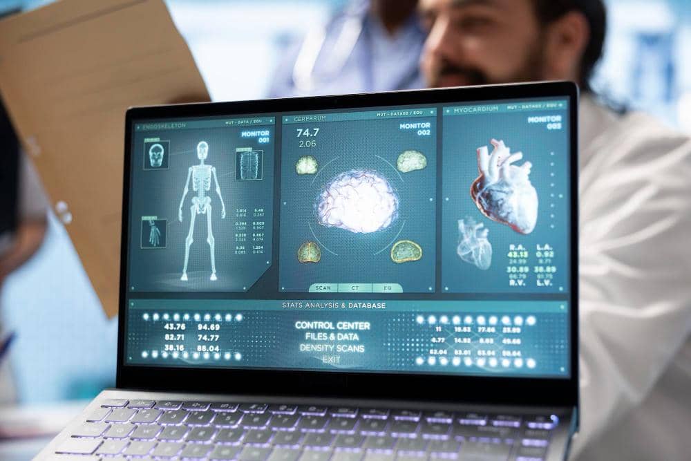 Tes Darah AI Ini Bisa Prediksi Stroke 15 Tahun Lebih Awal