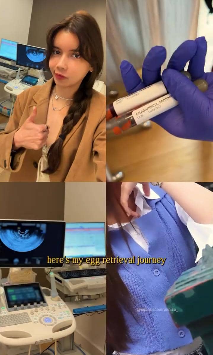 Kolase foto seorang wanita di klinik dengan alat medis, tabung darah berlabel, serta layar ultrasonografi saat menjalani prosedur pembekuan sel telur.