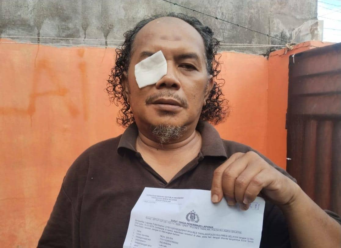 Liput KDRT, Jurnalis di Takalar Diduga Dianiaya-Diancam Dibunuh