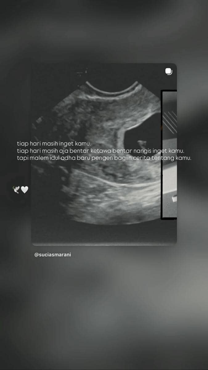 Gambar hasil USG berwarna hitam putih dengan tulisan bernada emosional tentang kenangan dan kehilangan di atasnya.