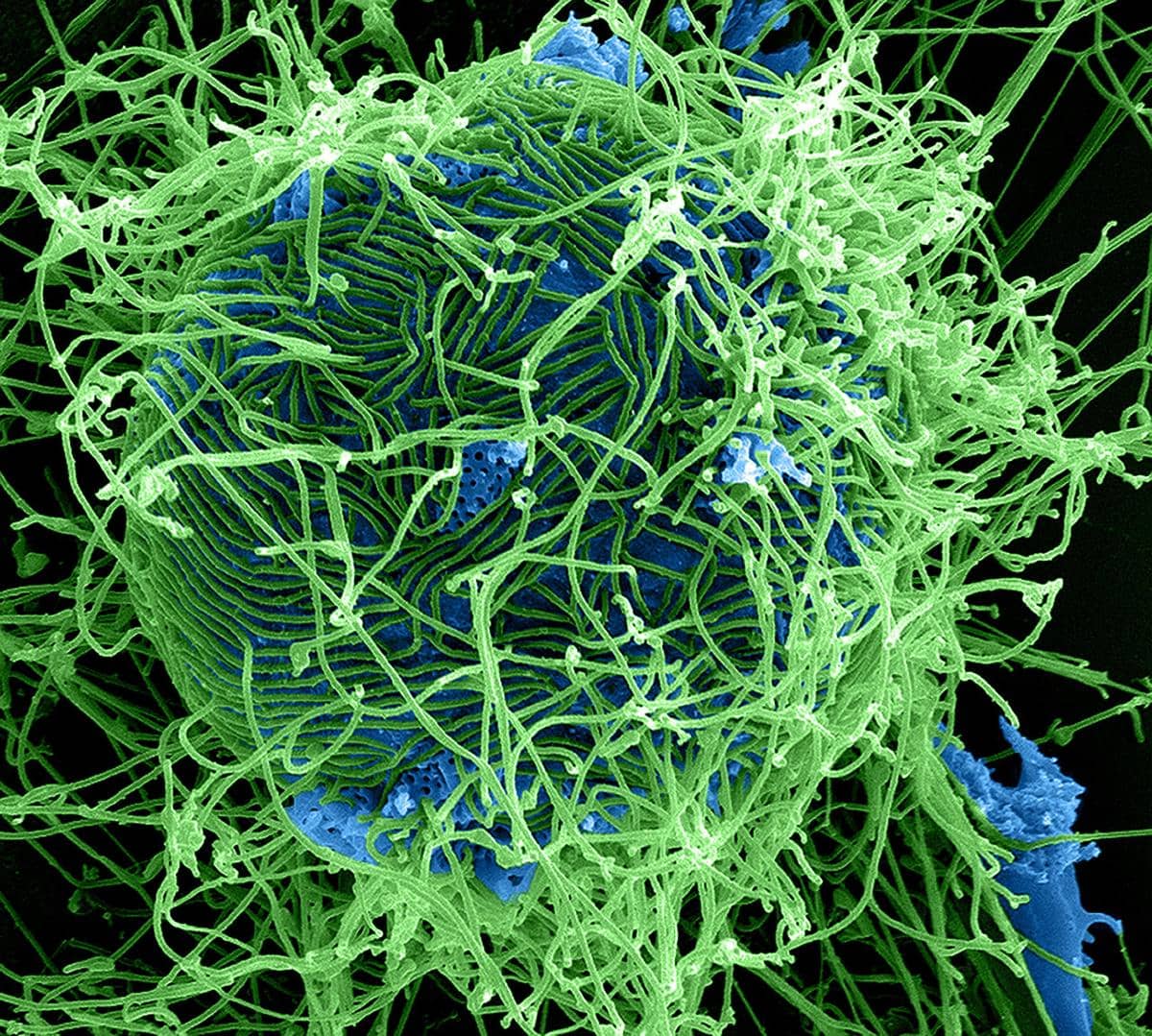 ilustrasi virus Ebola