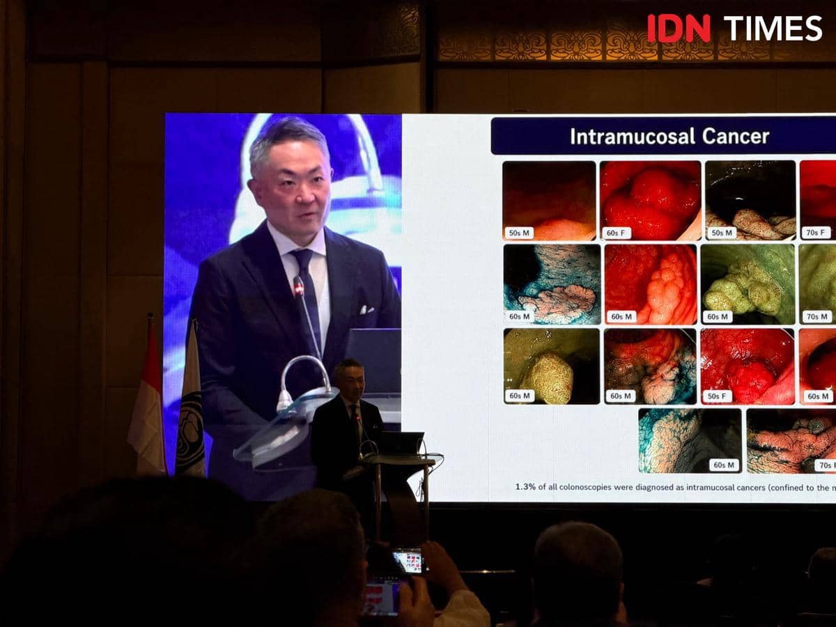 Seorang pembicara mengenakan setelan jas berbicara di podium dengan layar besar menampilkan presentasi tentang kanker intramukosa di sebuah konferensi medis.