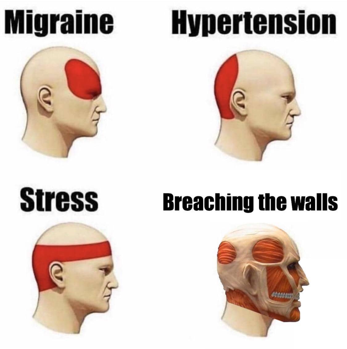 meme anime tentang sakit kepala