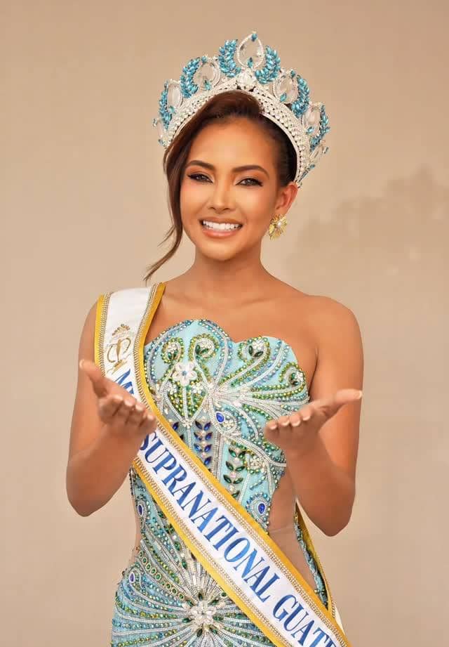Finalis Miss Supranational 2026 dengan Pengikut Terbanyak di IG