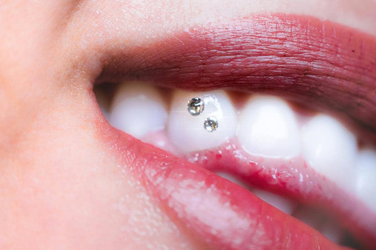 Mengenal Tooth Gems, Aksesori Gigi yang Dipakai Naykilla