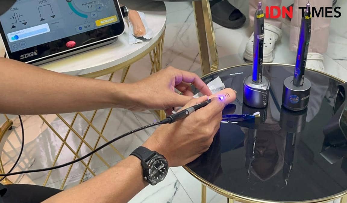 Metode Khitan Baru RH Light Fusion, Pakai Teknologi Laser Cahaya Murni