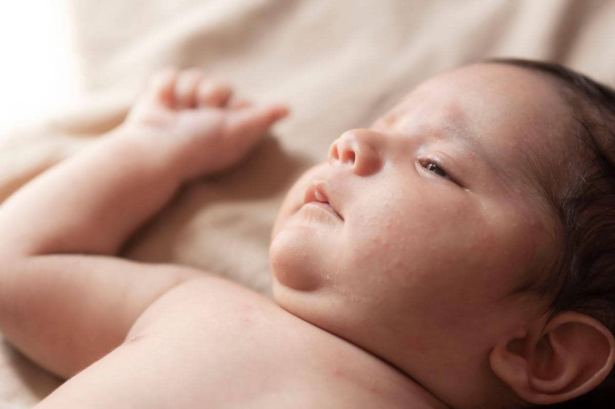 Alergi Susu Sapi Ancam Tumbuh Kembang Anak, SADAR Alergi Diperkuat